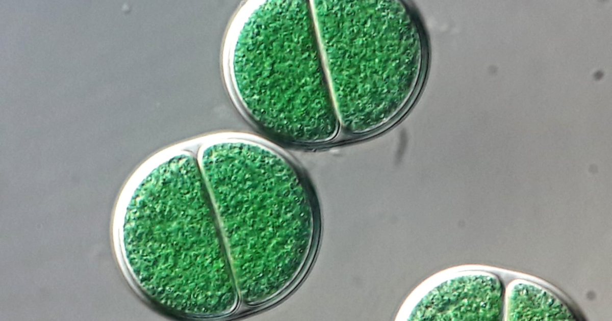 Chroococcus sp. – Blue-green algae that produce oxygen | Micropia | ARTIS