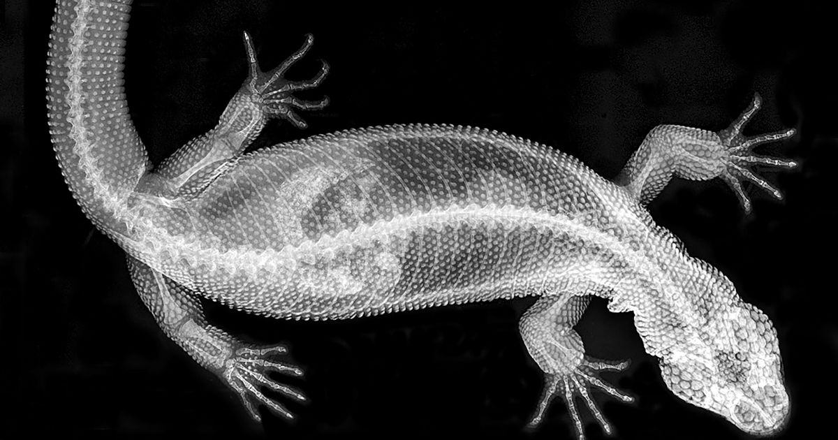 Ruggengraat | ARTIS